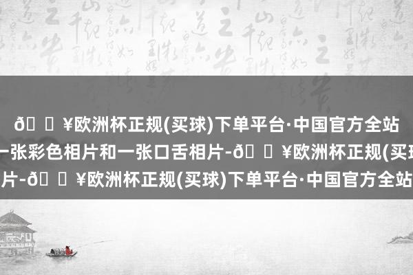 🔥欧洲杯正规(买球)下单平台·中国官方全站每一位拍摄对象会有一张彩色相片和一张口舌相片-🔥欧洲杯正规(买球)下单平台·中国官方全站